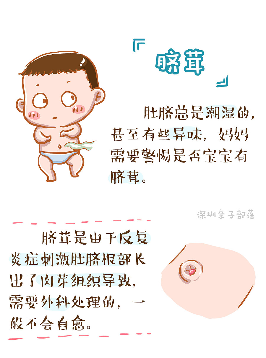 新生儿肚脐护理相关知识|短篇\/四格漫画|动漫|云