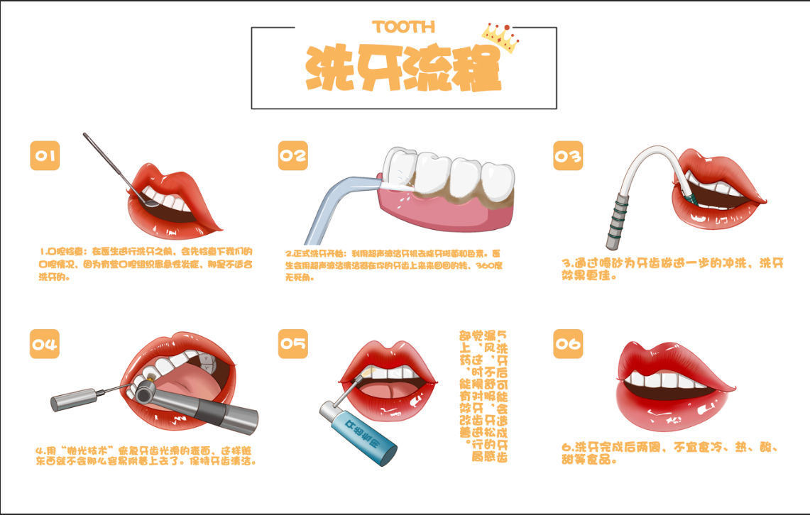洗牙流程图