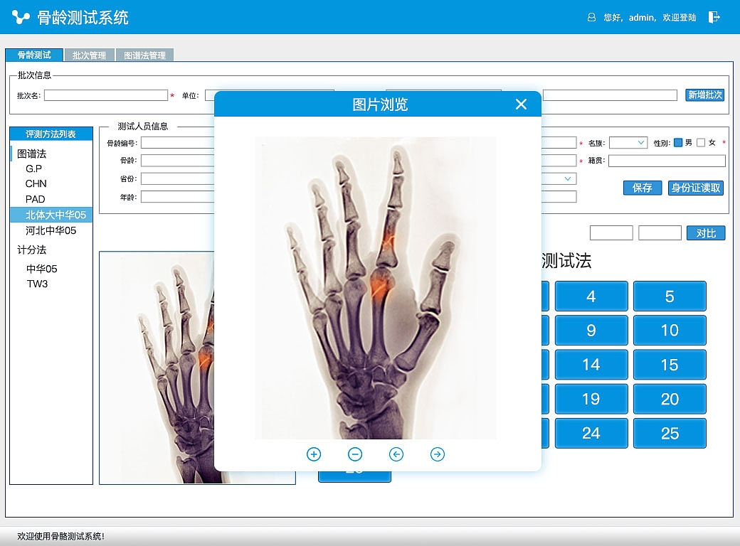骨龄测试软件系统|UI|软件界面|赵志虎 - 原创作