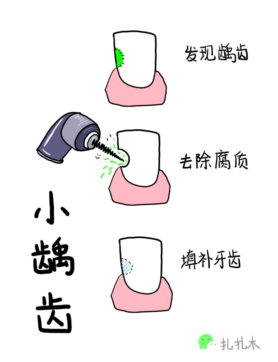 一个牙科老患者的胡说八道|其他绘画|插画|扎扎