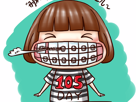 牙套日记第十五周目