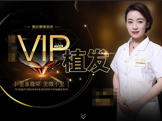 VIP植发