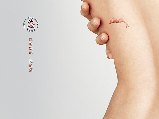 公益-你的伤疤我的痛系列