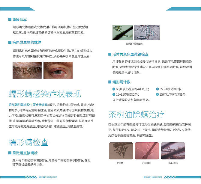 蠕形螨性睑缘炎科普（图ZMTY4MjU5MTk2） - 宣传物料 - 站酷设计师海袅1号原创素材 - 站酷ZCOOL