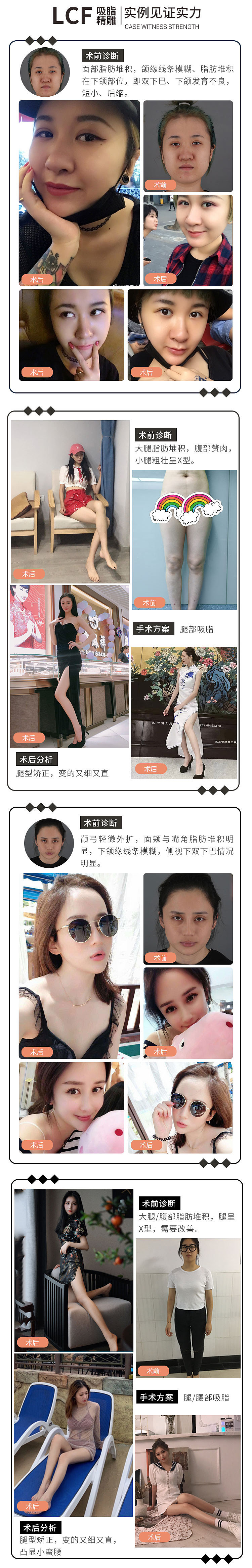 医美吸脂详情页
