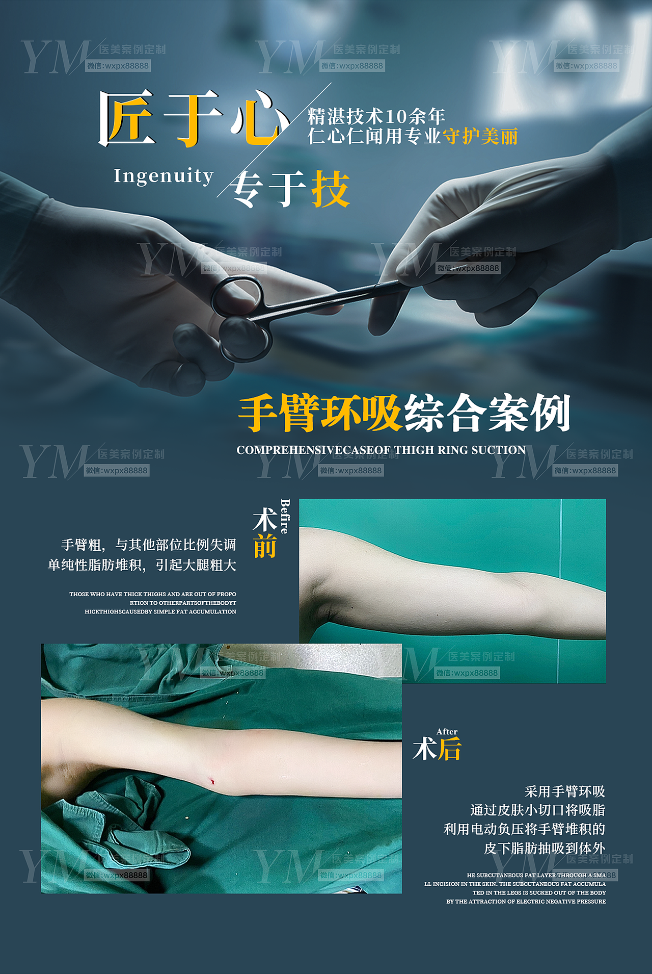 医美案例对比图