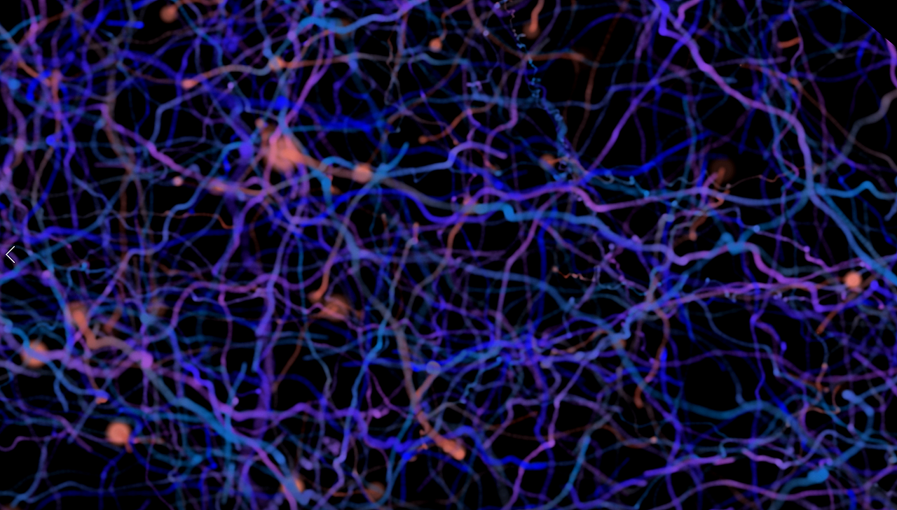 BRAIN 神經(jīng)元發(fā)散效果（圖ZMTQ5NjQ5NzY4） - 影視后期 - 站酷設計師認真真原創(chuàng)素材 - 站酷ZCOOL