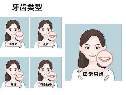 医美、牙齿类型