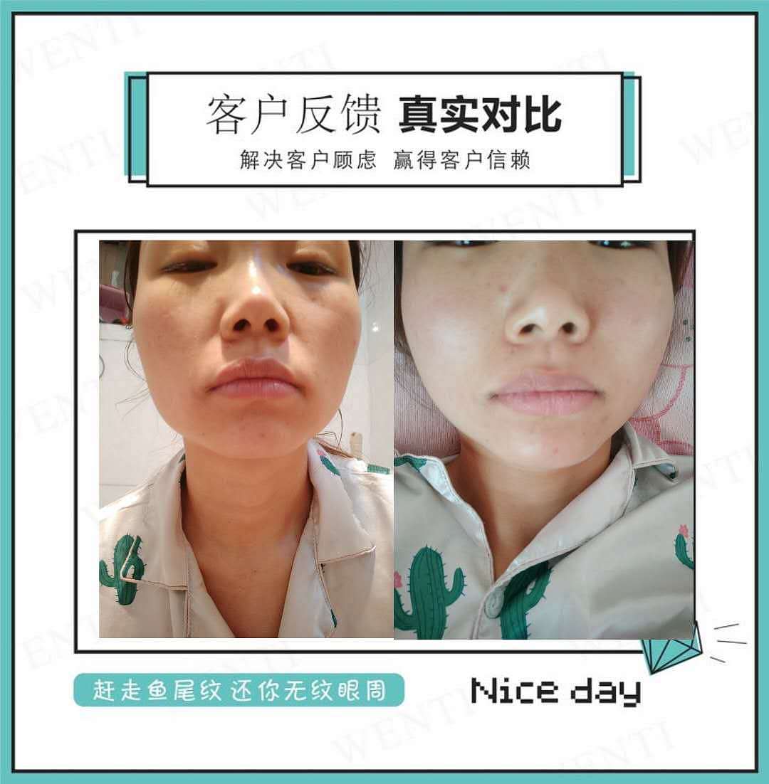 一颗向上的心|不该有下坠的皱纹|雯媞去皱贴|雯媞魔贴（图ZMTUxMjA3MTM2） - 品牌 - 站酷设计师墨小先生原创素材 - 站酷ZCOOL