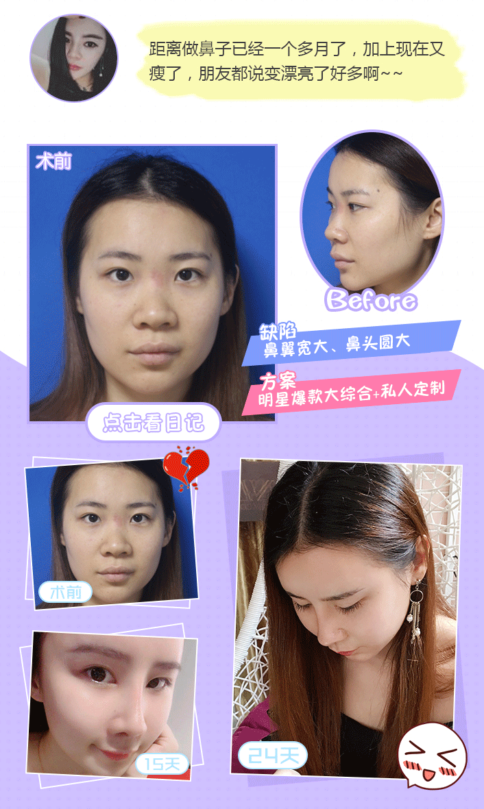 鼻综合详情页