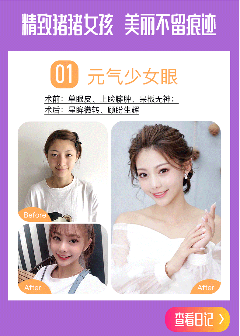 医美详情页——张霞飞医生双眼皮（图ZMTQ1MTI3ODAw） - 电商 - 站酷设计师平凡的阿宝原创素材 - 站酷ZCOOL