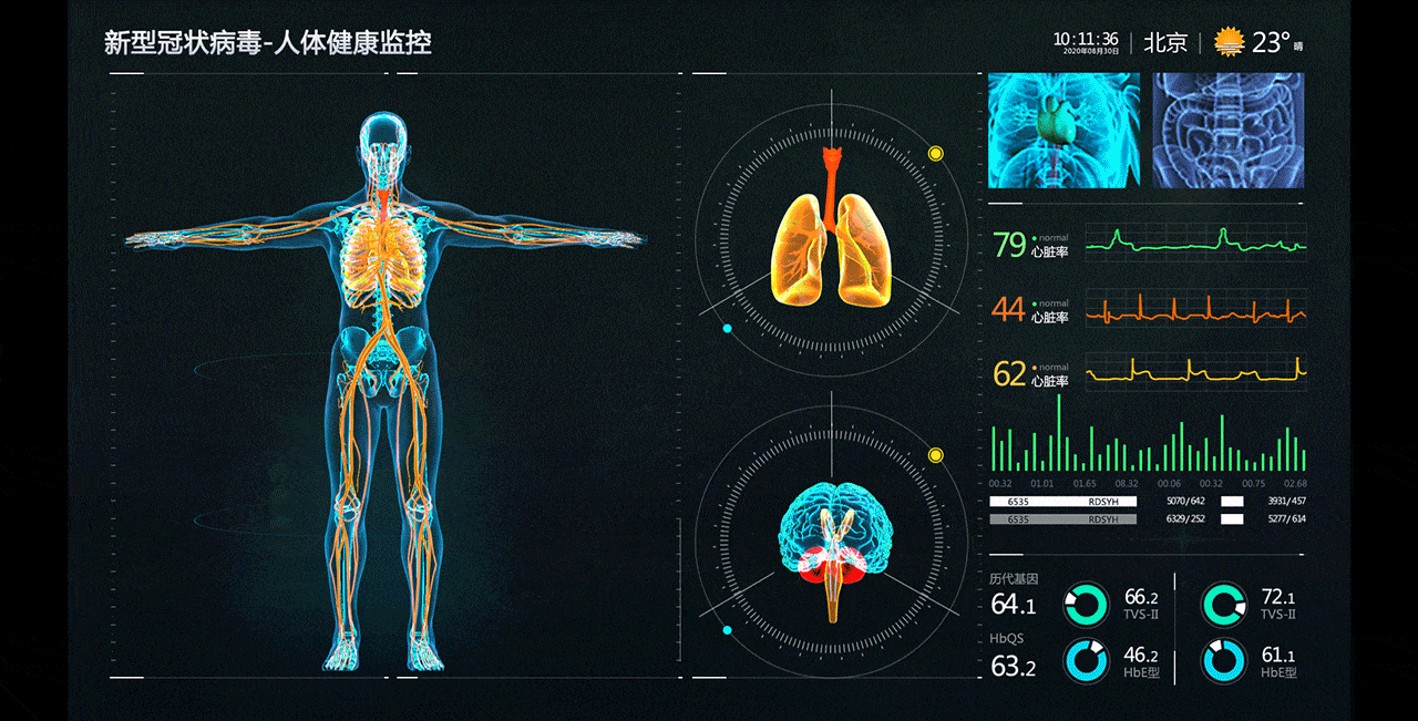 新冠肺炎数据可视化新视角（图ZMjMxMzE1ODg0） - 动效设计 - 站酷设计师聂永真原创素材 - 站酷ZCOOL