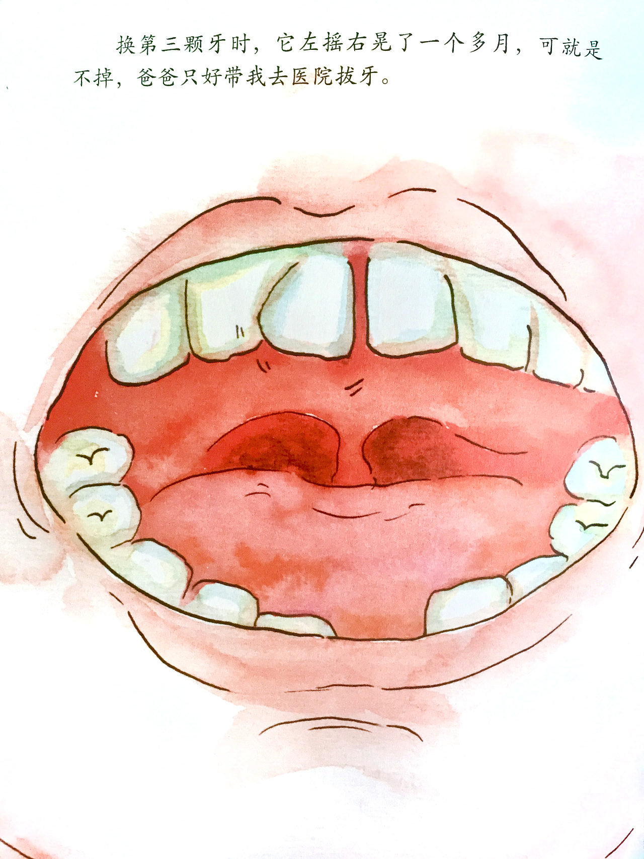 牙齿不齐矫正的黄金年龄 苏州牙齿矫正费用多少 - 知乎
