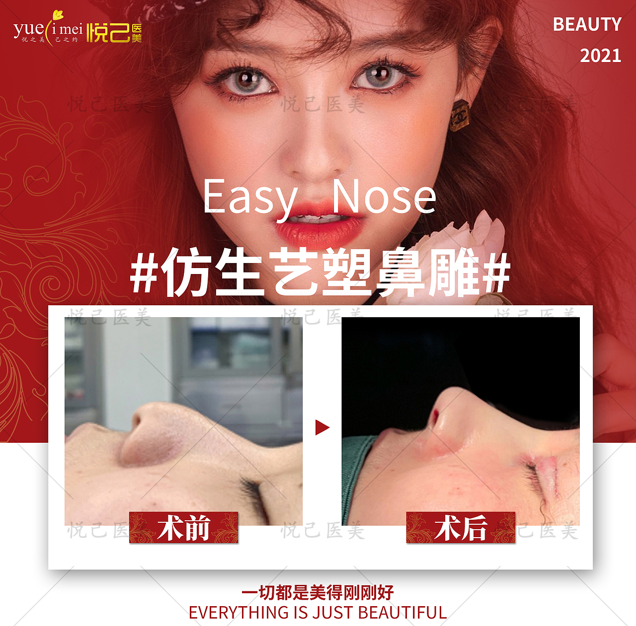 医美案例对比图