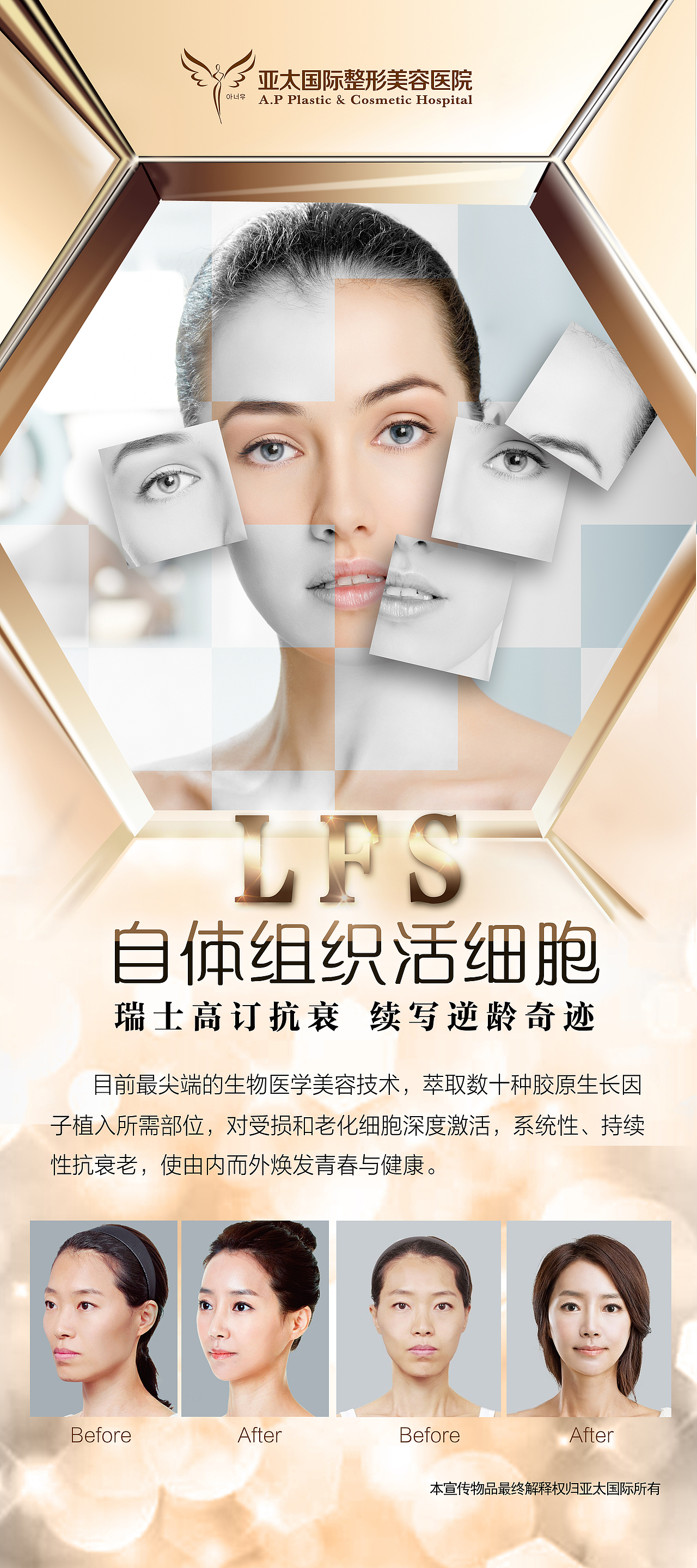 医美项目包装：展架设计（图ZNTU2MDk4NDA=） - 宣传物料 - 站酷设计师是舒舒不是叔叔原创素材 - 站酷ZCOOL