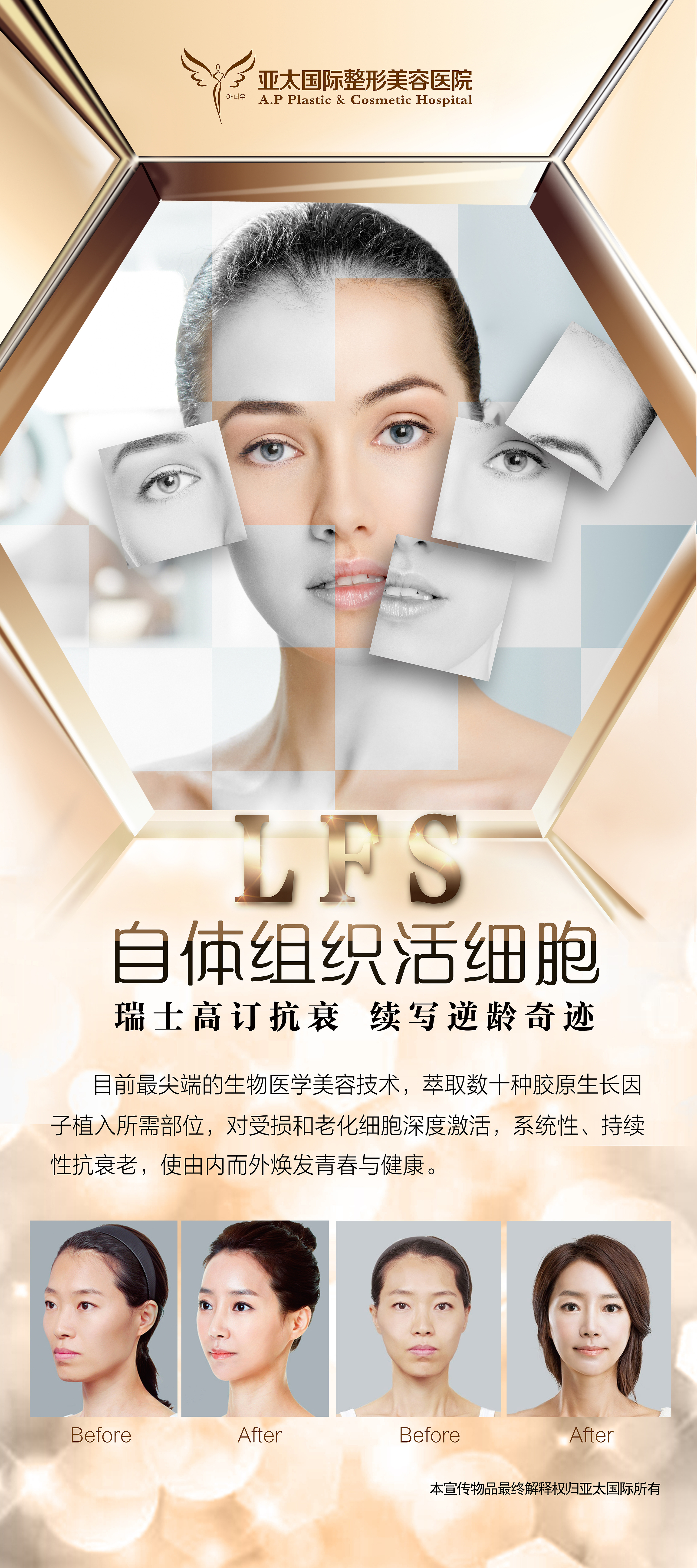 医美项目包装:展架设计