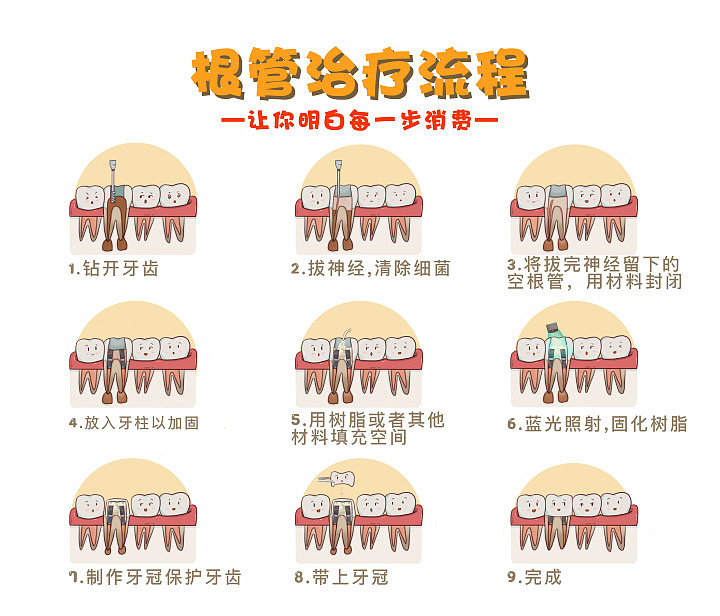 根管治疗流程_刘玉美口腔插画-站酷zcool