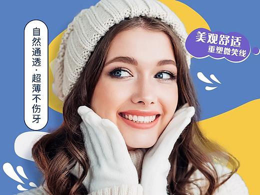 e-max牙贴面详情