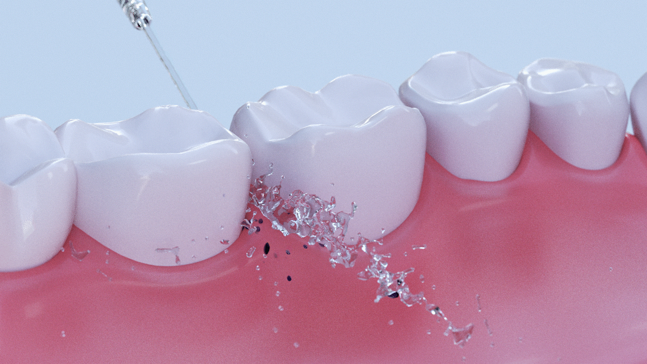 洗牙器产品动画-三维视频、3D产品宣传片