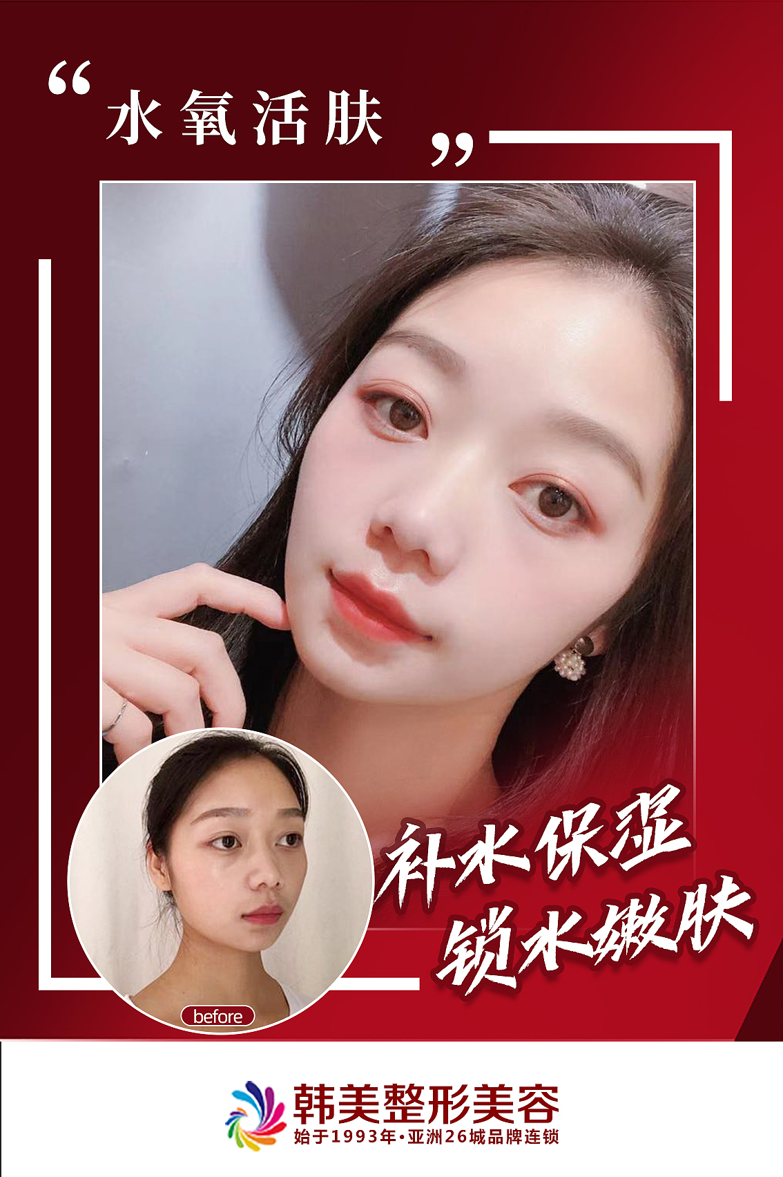 4月砍价项目朋友圈推广