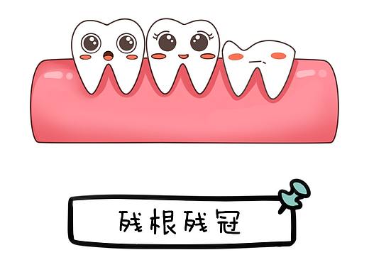 12种问题智齿
