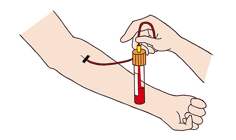 微信推送文章插图:ctc检测|插画|艺术插画|free_world_原创作品-站酷