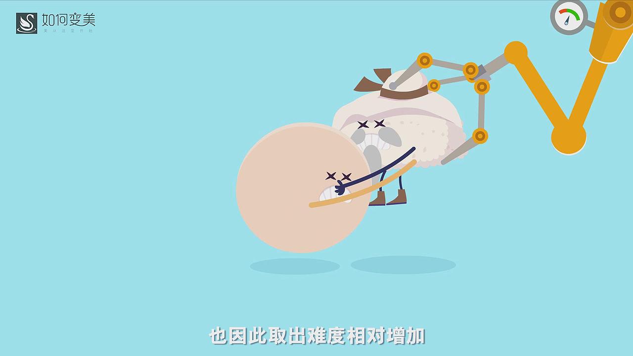 MG动画:两分钟看懂隆鼻