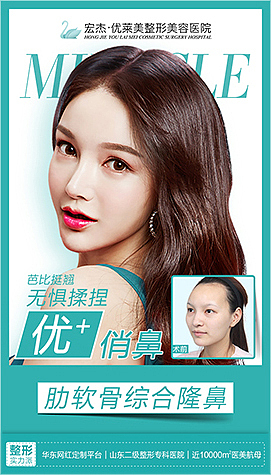 整形案例（图ZMTgzODc0MjM2） - 宣传物料 - 站酷设计师shensuyi原创素材 - 站酷ZCOOL