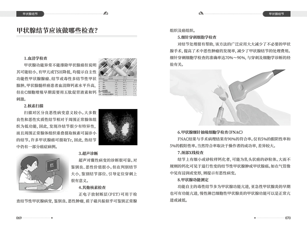 甲状腺疾病健康手册