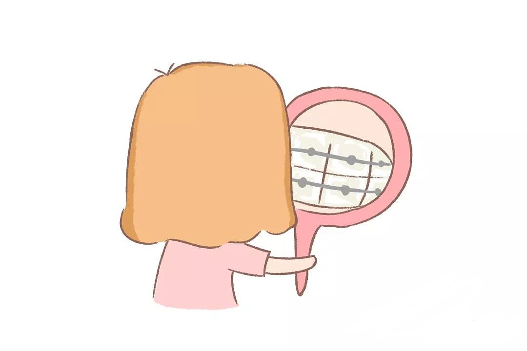 牙套保护牙釉质（图ZMjE1MzU0MTY4） - 艺术插画 - 站酷设计师没事画画哦原创素材 - 站酷ZCOOL