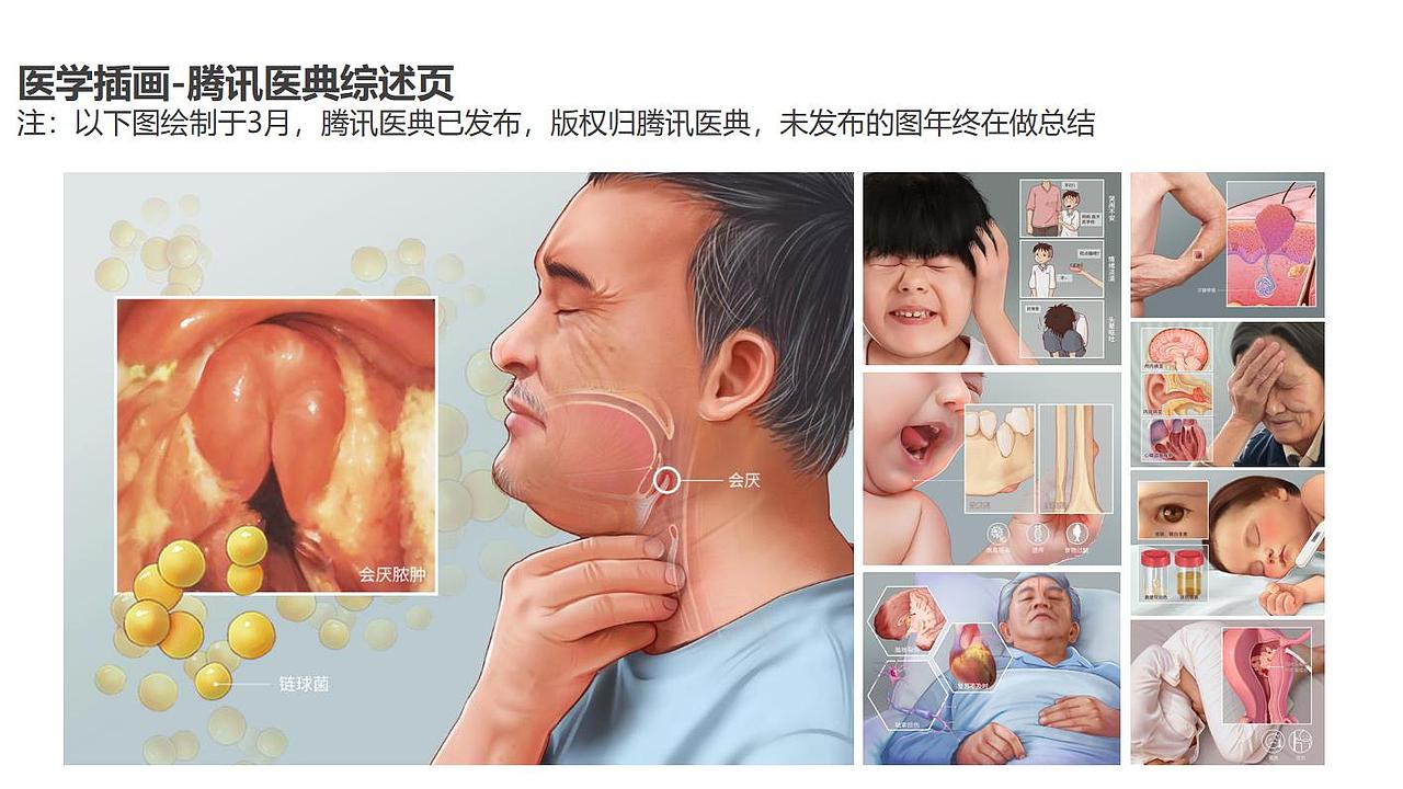 2021年中總結(jié)-下半年希望成為更優(yōu)秀的醫(yī)學(xué)插畫師（圖ZMjYxMjU4MzAw） - 商業(yè)插畫 - 站酷設(shè)計(jì)師sunny科研插畫原創(chuàng)素材 - 站酷ZCOOL