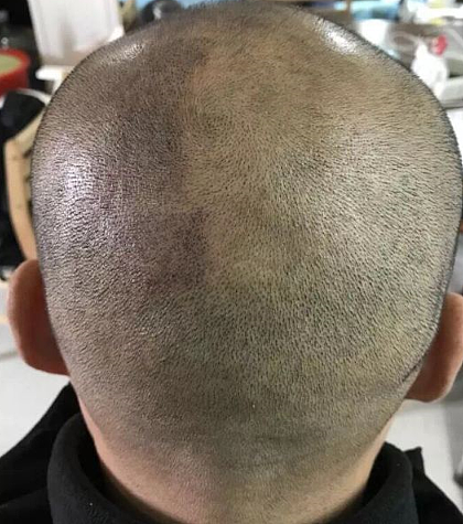 发量少的男生想要纹头发无锡纹头发就来无锡远航纹发