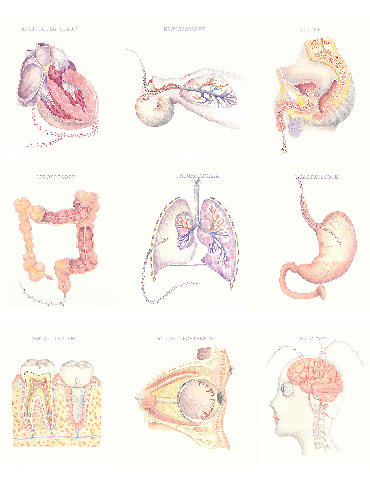 关于器官手术想象的一系列（图ZMTAwMDYxNTI0） - 创作习作 - 站酷设计师邓米奇V原创素材 - 站酷ZCOOL