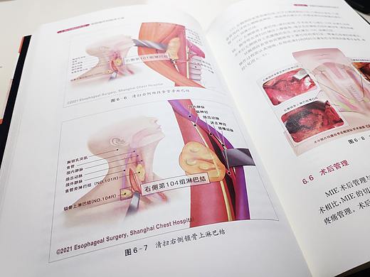 医学图谱 | 食管外科批量配图