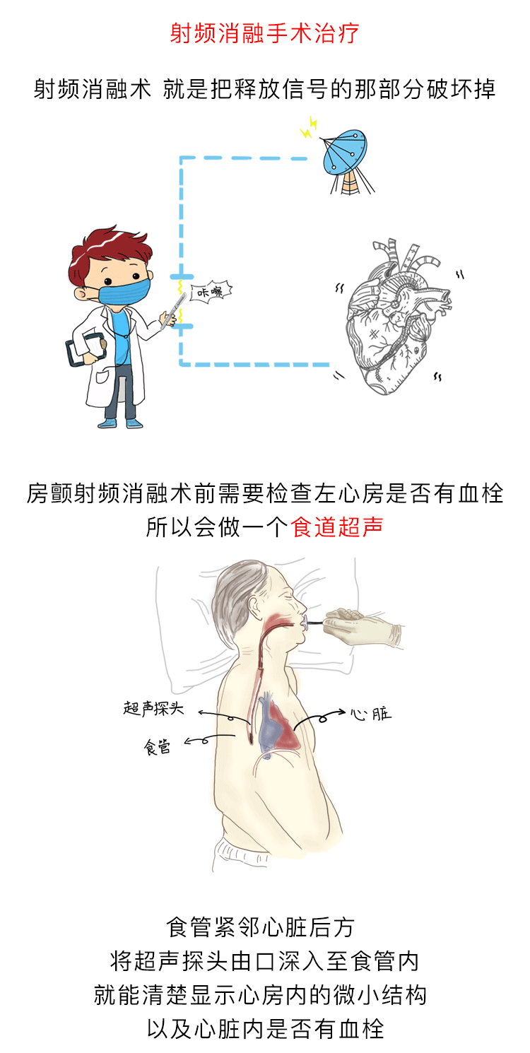 房颤漫画（图ZMTE5NzUxOTg0） - 商业插画 - 站酷设计师G_Fsky原创素材 - 站酷ZCOOL