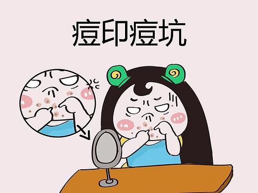 医美漫画，祛痘