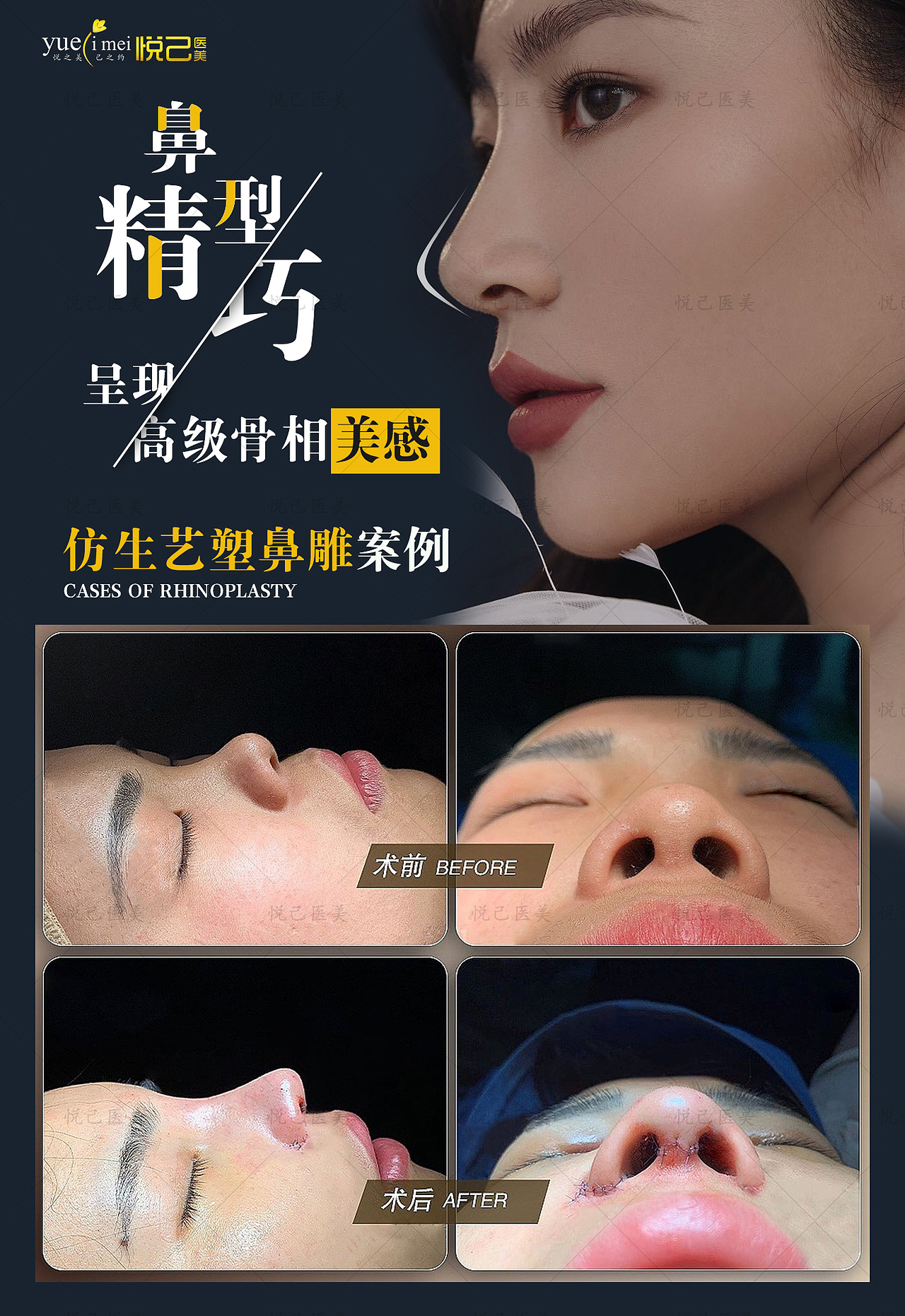 医美案例对比图