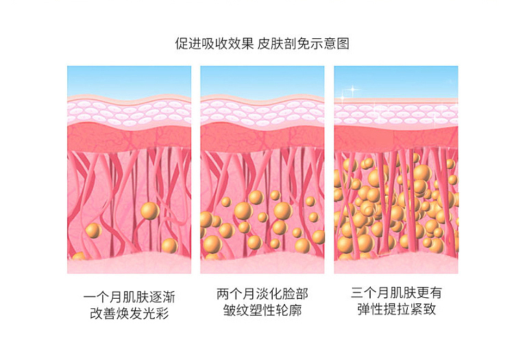 科顿V-MATE 音波线雕/详情页/美容仪器