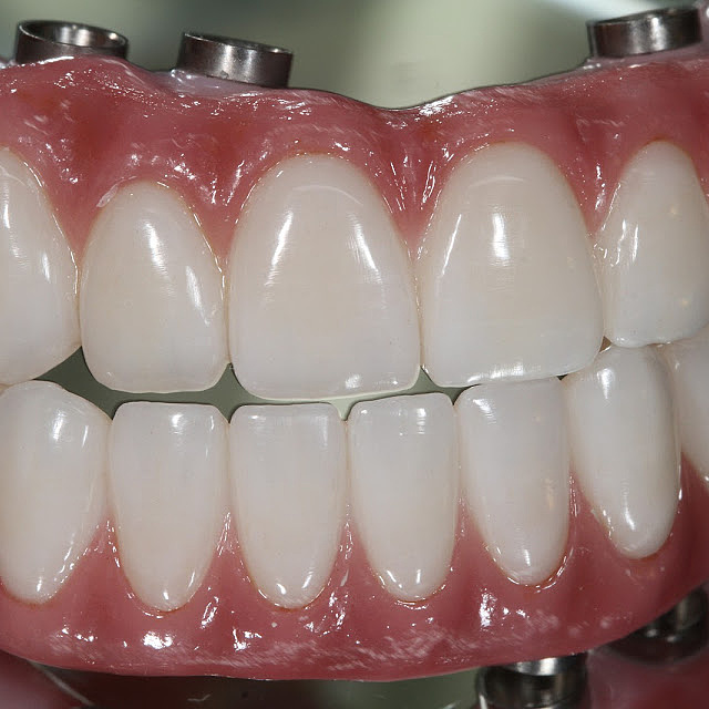 假牙牙齿