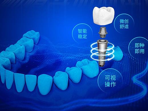 医疗口腔-信息流物料-广告图