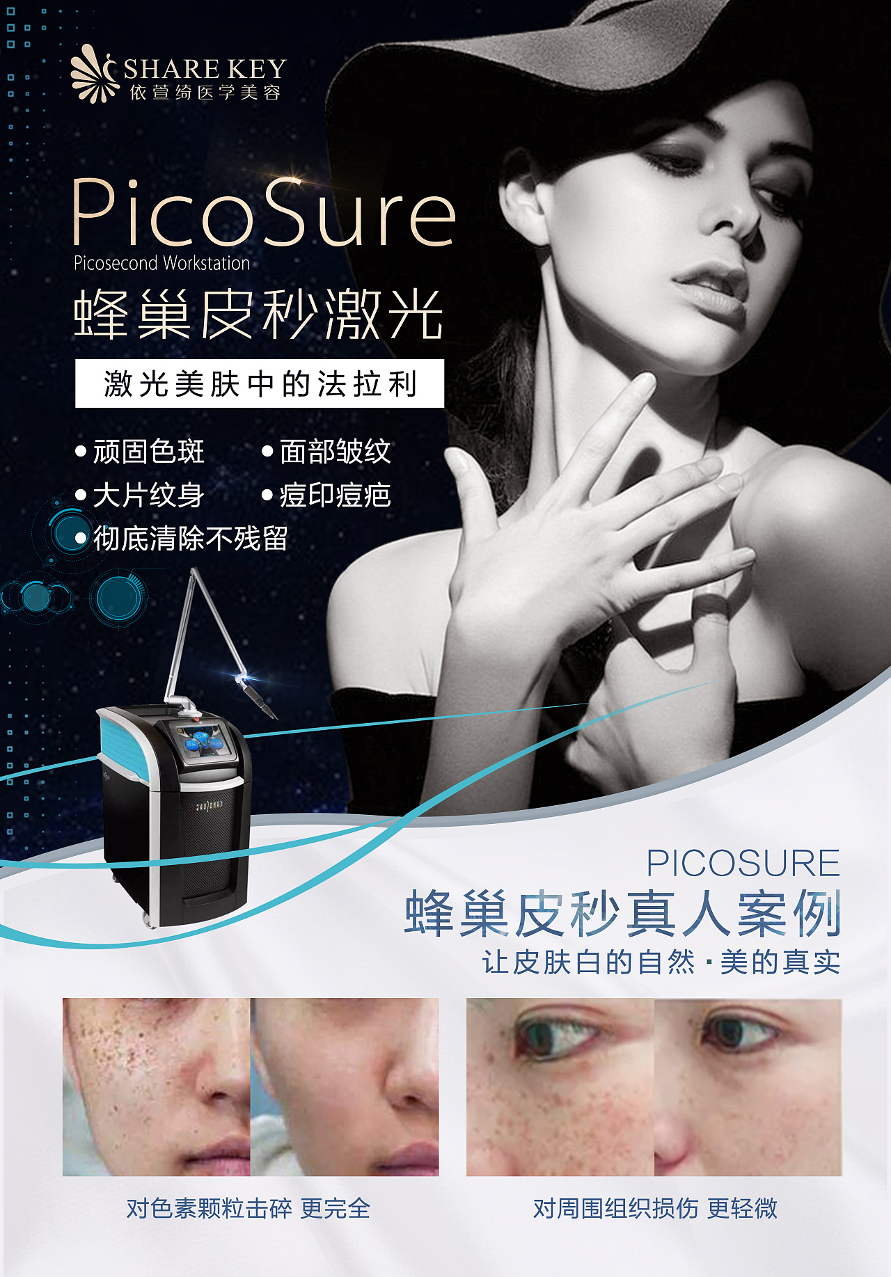 皮秒激光海报医美