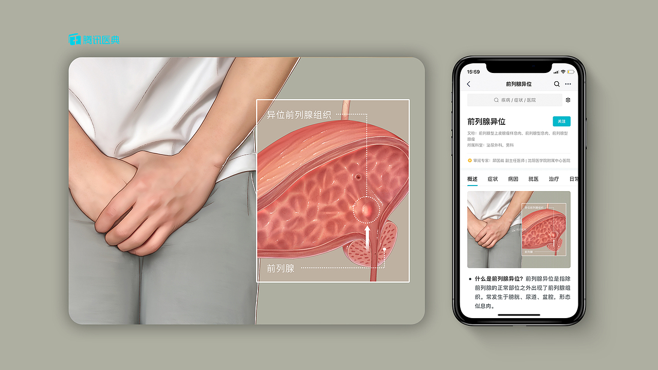 2020腾讯医典医学插画作品集（图ZMjM2OTEyNzI0） - 艺术插画 - 站酷设计师不当咸鱼的咸鱼原创素材 - 站酷ZCOOL