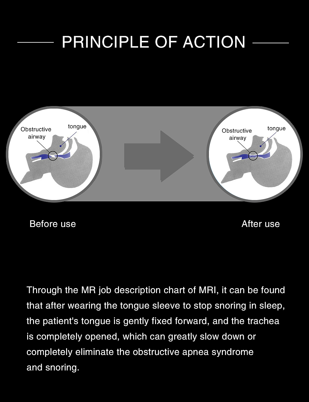 止鼾器（图ZMTg5MjM0MjQ0） - 电商 - 站酷设计师酷彬彬原创素材 - 站酷ZCOOL