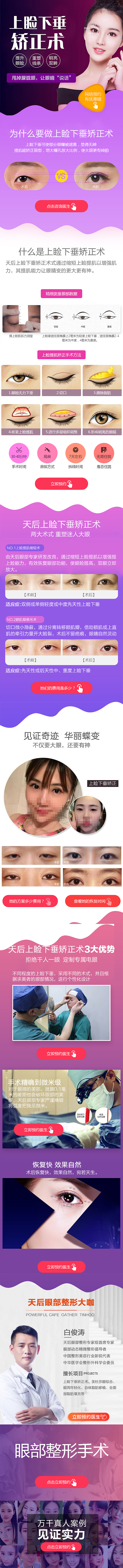 上睑下垂矫正术-WAP专题