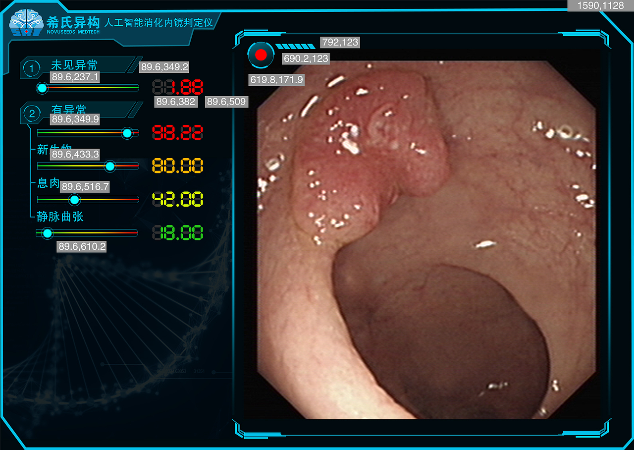 医学AI人工智能判定仪产品界面设计（图ZMTI5Mjg0MjMy） - 软件界面 - 站酷设计师RU果原创素材 - 站酷ZCOOL