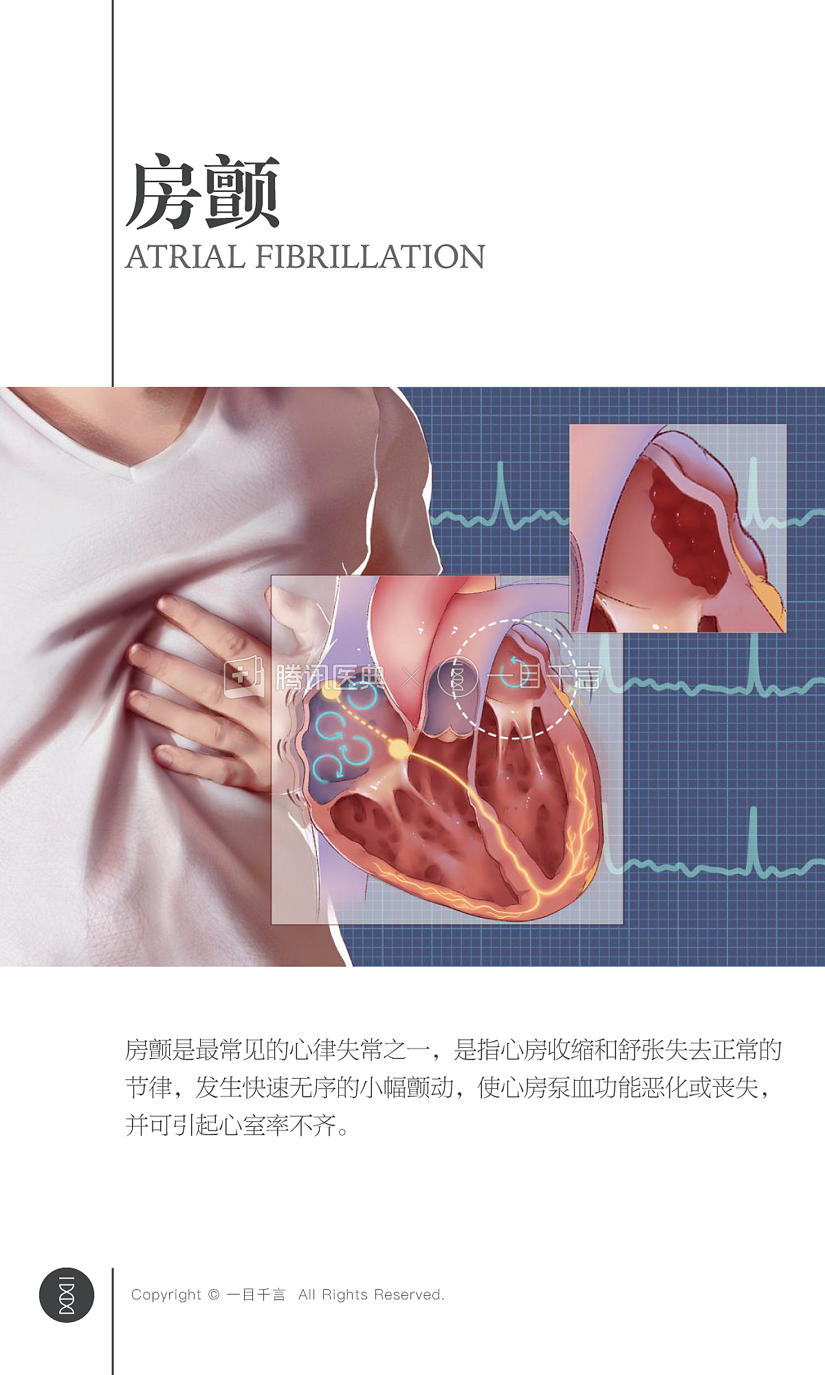 【医学插画】作品展示