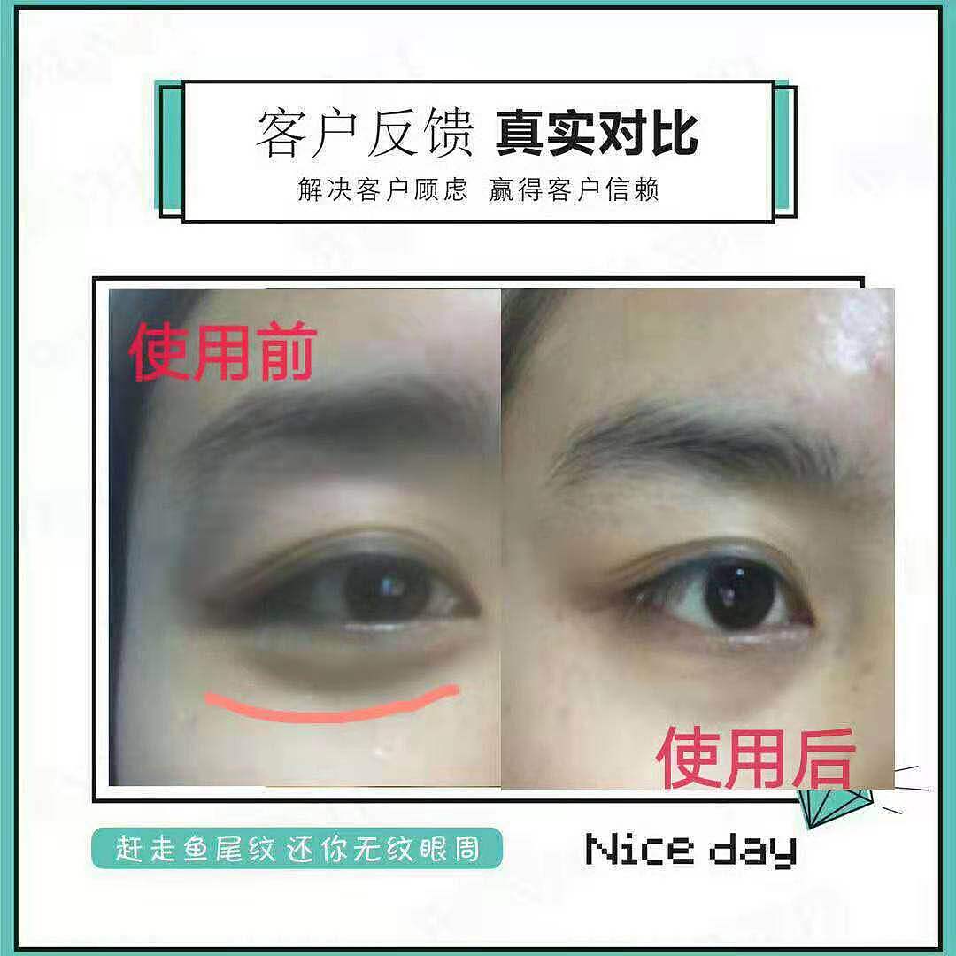 一颗向上的心|不该有下坠的皱纹|雯媞去皱贴|雯媞魔贴（图ZMTUxMjA3MDk2） - 品牌 - 站酷设计师墨小先生原创素材 - 站酷ZCOOL