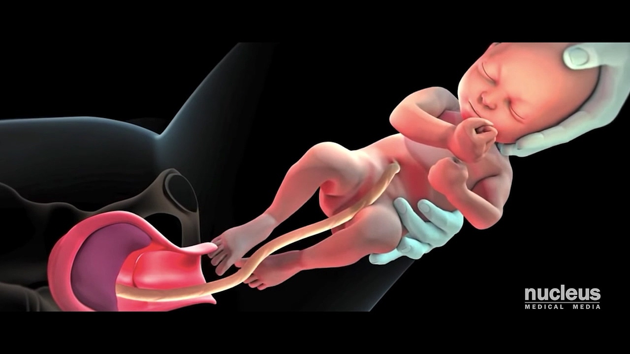 顺产视频二次创作