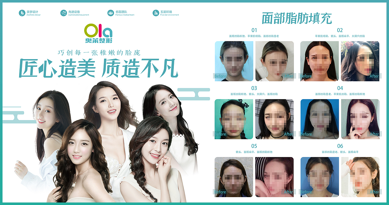 医美案例绿色整形户外展板