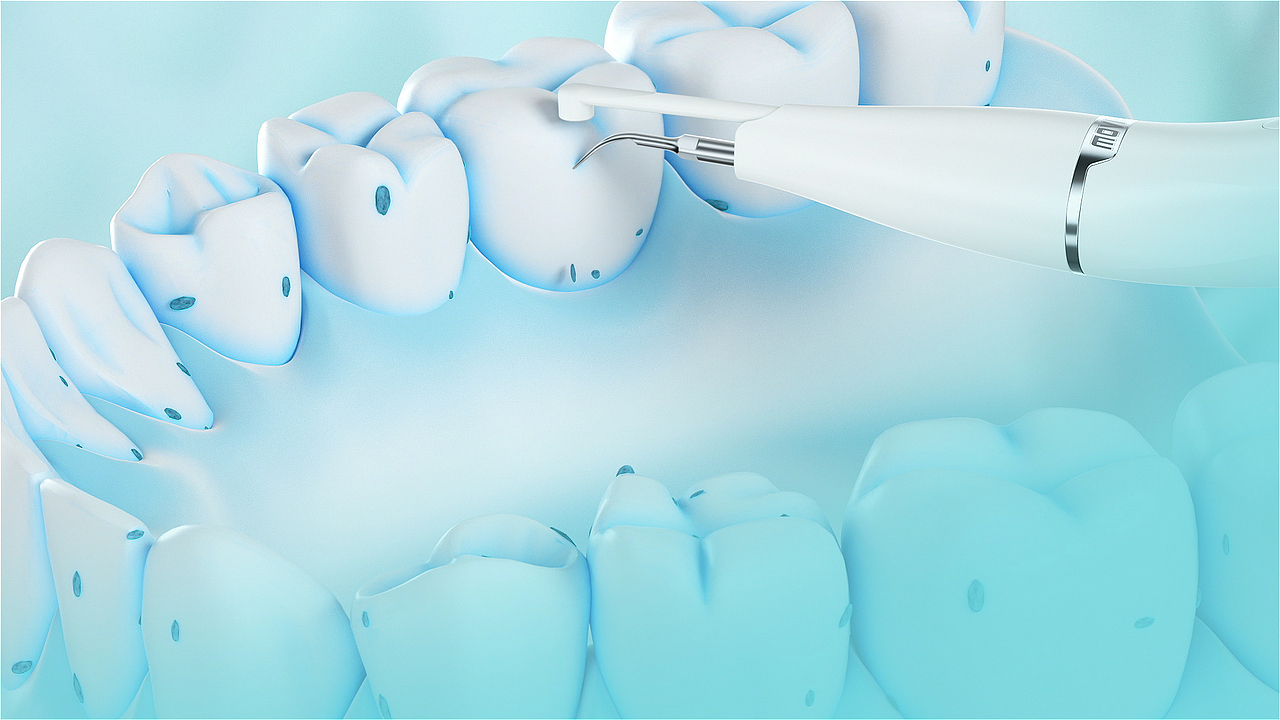 洁牙仪 功能操作动画视频